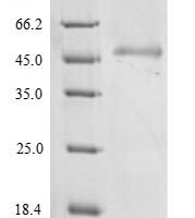 Pig E-selectin (SELE), partial Recombinant Protein, N-His - BioCrest Sci