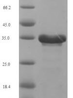 Human cytomegalovirus Viral interleukin-10 homolog (UL111A) Recombinant Protein - BioCrest Sci