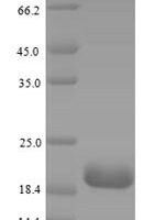 Mouse Complement receptor type 2 (Cr2), partial Recombinant Protein, N-His, aa 12–145 - BioCrest Sci