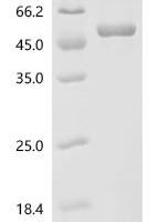 Mouse Sulfide:quinone oxidoreductase, mitochondrial (Sqor) Recombinant Protein - BioCrest Sci