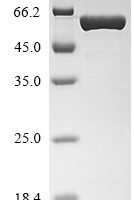 Human Insulin receptor substrate 1 (IRS1), partial,Biotinylated Recombinant Protein - BioCrest Sci