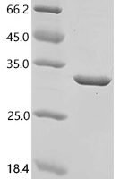 Mouse Fibroblast growth factor 9 (Fgf9) Recombinant Protein, N-His - BioCrest Sci