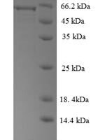 Human Regulator of G-protein signaling 7 (RGS7) Recombinant Protein - BioCrest Sci