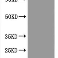 Human Solute carrier family 23 member 2 (SLC23A2)-VLPs Recombinant Protein - BioCrest Sci