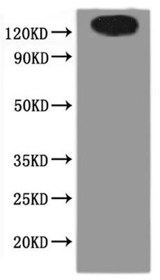 Human Solute carrier family 23 member 2 (SLC23A2)-VLPs Recombinant Protein, Homo sapiens (Human), Mammalian cell, C-terminal 6xHis-tagged(This tag can be tested only under denaturing conditions), 72.0 kDa, purity >The purity information is not available for VLPs proteins.