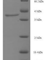 Human Lutropin-choriogonadotropic hormone receptor (LHCGR), partial Recombinant Protein, N-His, aa 27–363, E.coli - BioCrest Sci