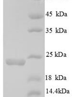 Mouse Integrin alpha-L (Itgal), partial Recombinant Protein, N-His, aa 153–325, E.coli - BioCrest Sci