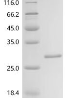Streptococcus agalactiae serotype III Single-stranded DNA-binding protein 1 (ssb1) Recombinant Protein, C-His, aa 1–163, E.coli - BioCrest Sci