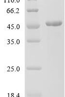 Human Interleukin-11 receptor subunit alpha (IL11RA), partial Recombinant Protein - BioCrest Sci