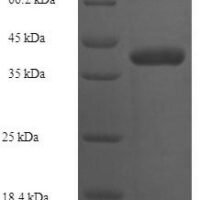 Escherichia coli 1-acyl-sn-glycerol-3-phosphate acyltransferase (plsC) Recombinant Protein, N-His-SUMO - BioCrest Sci
