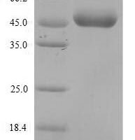 Mouse Paired immunoglobulin-like receptor B (Pirb), partial Recombinant Protein - BioCrest Sci