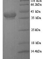 Escherichia coli CFA/I fimbrial subunit E (cfaE) Recombinant Protein, N-His - BioCrest Sci