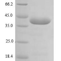 Mouse Platelet glycoprotein VI (Gp6), partial Recombinant Protein - BioCrest Sci