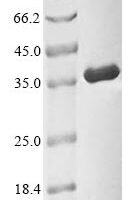 Human Cyclin-dependent kinase 1 (CDK1) Recombinant Protein - BioCrest Sci