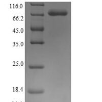 Human Keratin, type I cytoskeletal 10 (KRT10) Recombinant Protein - BioCrest Sci