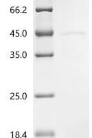 Human Casein kinase I isoform delta (CSNK1D ) Recombinant Protein - BioCrest Sci