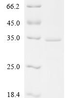 Human Appetite-regulating hormone (GHRL), Partial Recombinant Protein - BioCrest Sci