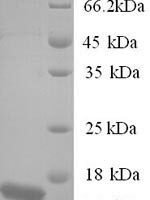 Human Protein BEX3 (NGFRAP1) Recombinant Protein, N-His - BioCrest Sci