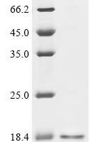 Macaca fascicularis Hemoglobin subunit beta (HBB) Recombinant Protein - BioCrest Sci