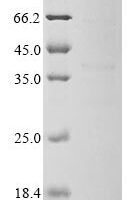Human Putative C-type lectin-like domain family 1 (CLECL1P), partial Recombinant Protein - BioCrest Sci