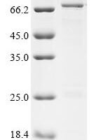 Human Fermitin family homolog 2 (FERMT2) Recombinant Protein - BioCrest Sci