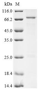 Human Fermitin family homolog 2 (FERMT2) Recombinant Protein, Homo sapiens (Human), E.coli, C-terminal 6xHis-tagged, 83.8 kDa, purity >≥ 85% as determined by SDS-PAGE.