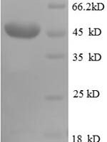 Human CD320 antigen (CD320), partial Recombinant Protein - BioCrest Sci