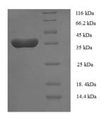 Human Tumor necrosis factor ligand superfamily member 13B protein (TNFSF13B), partial Recombinant Protein - BioCrest Sci