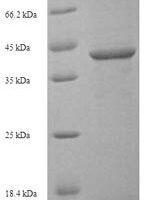 Human Sialic acid-binding Ig-like lectin 15 (SIGLEC15), partial Recombinant Protein - BioCrest Sci