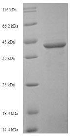 Human Sialic acid-binding Ig-like lectin 15 (SIGLEC15), partial Recombinant Protein, Homo sapiens (Human), E.coli, N-terminal 6xHis-SUMO-tagged, 42.6 kDa, purity >≥ 90% as determined by SDS-PAGE.