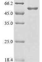 Influenza A virus Neuraminidase (NA), partial Recombinant Protein - BioCrest Sci