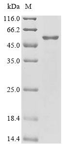 Influenza A virus Neuraminidase (NA), partial Recombinant Protein, Influenza A virus (strain A/Vietnam/1203/2004 H5N1), E.coli, C-terminal 6xHis-tagged, 52.3 kDa, purity >≥ 90% as determined by SDS-PAGE.