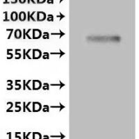 Rat Transient receptor potential cation channel subfamily V member 6 (Trpv6)-VLPs Recombinant Protein - BioCrest Sci
