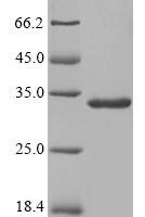 Rabbit Serum amyloid A-1 protein (SAA1) Recombinant Protein - BioCrest Sci