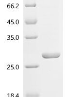 Abrus precatorius Abrin-a, partial Recombinant Protein - BioCrest Sci
