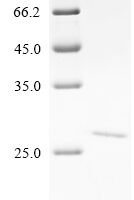 Human 5' (3')-deoxyribonucleotidase, cytosolic type (NT5C) Recombinant Protein - BioCrest Sci