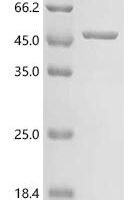 Human GDP-mannose 4,6 dehydratase (GMDS), partial Recombinant Protein - BioCrest Sci