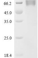 Human HERV-H_2q24.3 provirus ancestral Env polyprotein, partial Recombinant Protein - BioCrest Sci
