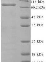 Human Bifunctional heparan sulfate N-deacetylase/N-sulfotransferase 1 (NDST1), partial Recombinant Protein - BioCrest Sci