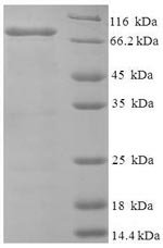Human Bifunctional heparan sulfate N-deacetylase/N-sulfotransferase 1 (NDST1), partial Recombinant Protein, Homo sapiens (Human), E.coli, N-terminal 6xHis-SUMO-tagged, 73.5 kDa, purity >≥ 90% as determined by SDS-PAGE.