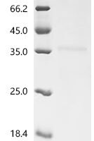 Human metapneumovirus Matrix protein (M) Recombinant Protein, C-10His - BioCrest Sci