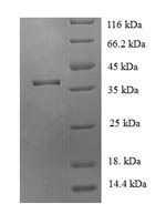 Human JmjC domain-containing protein 7 (JMJD7) Recombinant Protein, Homo sapiens (Human), E.coli, N-terminal 6xHis-tagged, 39.9 kDa, purity >≥ 90% as determined by SDS-PAGE.