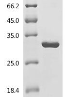 Mouse Desert hedgehog protein (Dhh), partial Recombinant Protein - BioCrest Sci