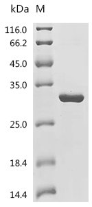 Mouse Desert hedgehog protein (Dhh), partial Recombinant Protein, Mus musculus (Mouse), E.coli, C-terminal 6xHis-tagged, 26.8 kDa, purity >≥ 95% as determined by SDS-PAGE.