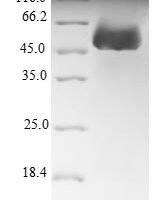 Arabidopsis thaliana rRNA 2-O-methyltransferase fibrillarin 1 (FIB1) Recombinant Protein - BioCrest Sci
