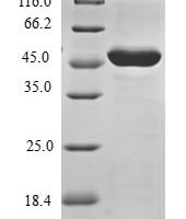 Human TP53-regulated inhibitor of apoptosis 1 (TRIAP1) Recombinant Protein - BioCrest Sci