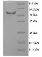 Human Nuclear receptor subfamily 1 group I member 3 (NR1I3), partial Recombinant Protein - BioCrest Sci