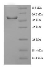 Human Nuclear receptor subfamily 1 group I member 3 (NR1I3), partial Recombinant Protein, Homo sapiens (Human), E.coli, N-terminal 6xHis-SUMO-tagged, 55.7 kDa, purity >≥ 90% as determined by SDS-PAGE.