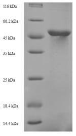 Saccharomyces cerevisiae Probable tRNA threonylcarbamoyladenosine biosynthesis protein KAE1 (KAE1) Recombinant Protein, Saccharomyces cerevisiae (strain ATCC 204508 / S288c) (Baker's yeast), E.coli, N-terminal 6xHis-tagged, 46.7 kDa, purity >≥ 90% as determined by SDS-PAGE.