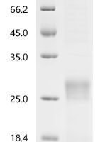 Human T-cell surface glycoprotein CD8 alpha chain(CD8A), partial Recombinant Protein - BioCrest Sci